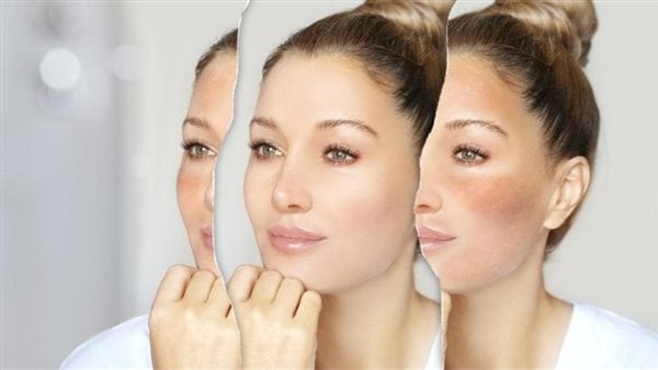 قناع البطاطس والعسل لتفتيح البشرة وترطيبها