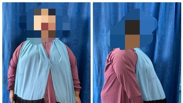 جراحة تجميل أسيوط تنجح في تكميم معدة لطفلة تعاني من سمنة مفرطة (صور)