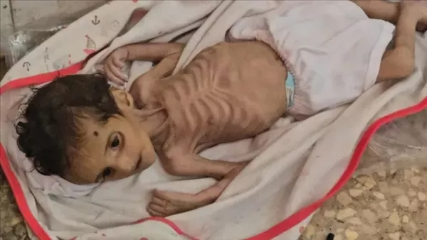 المرصد الأورومتوسطي: وفاة 1200 مسن في غزة بسبب المجاعة والآلاف مهددون بالموت