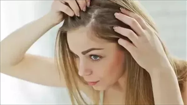 وصفة زيت الخروع والثوم لوقف تساقط الشعر