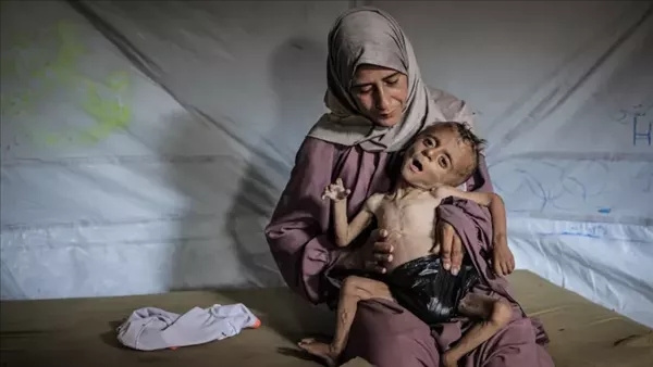 خبير قانون دولي: معاناة 320 ألف طفل من سوء التغذية في غزة جريمة خطيرة