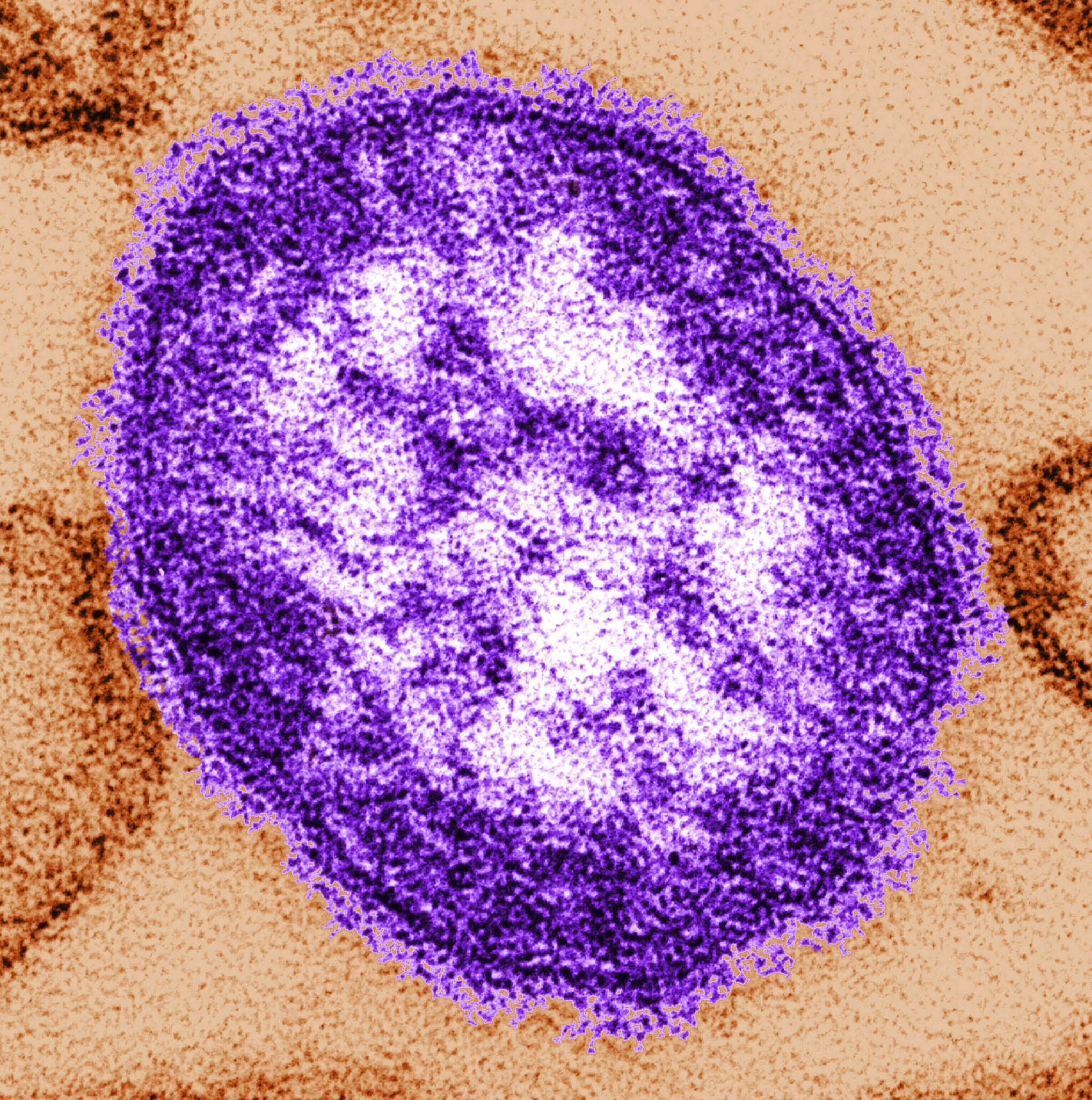 Province urges evacuee parents to have babies vaccinated for measles as number of cases rises