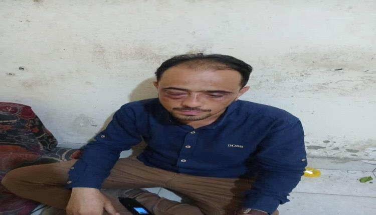 نجل قائد محور تعز يختطف رجل أعمال ويعتدي عليه بوحشية ويسحله إلى تحت أقدام تاجر.. تفاصيل