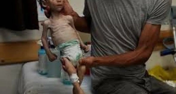 الأمهات والأطفال: التجويع يفتك بحاضر غزة ومستقبلها