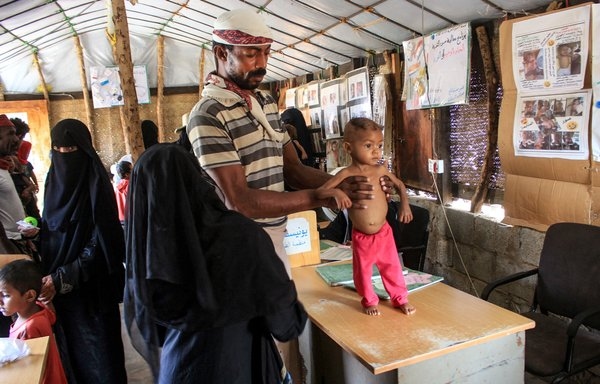 الأمم المتحدة: مجاعة وتفشٍ وبائي يهددان آلاف اليمنيين في حجة وأبين
