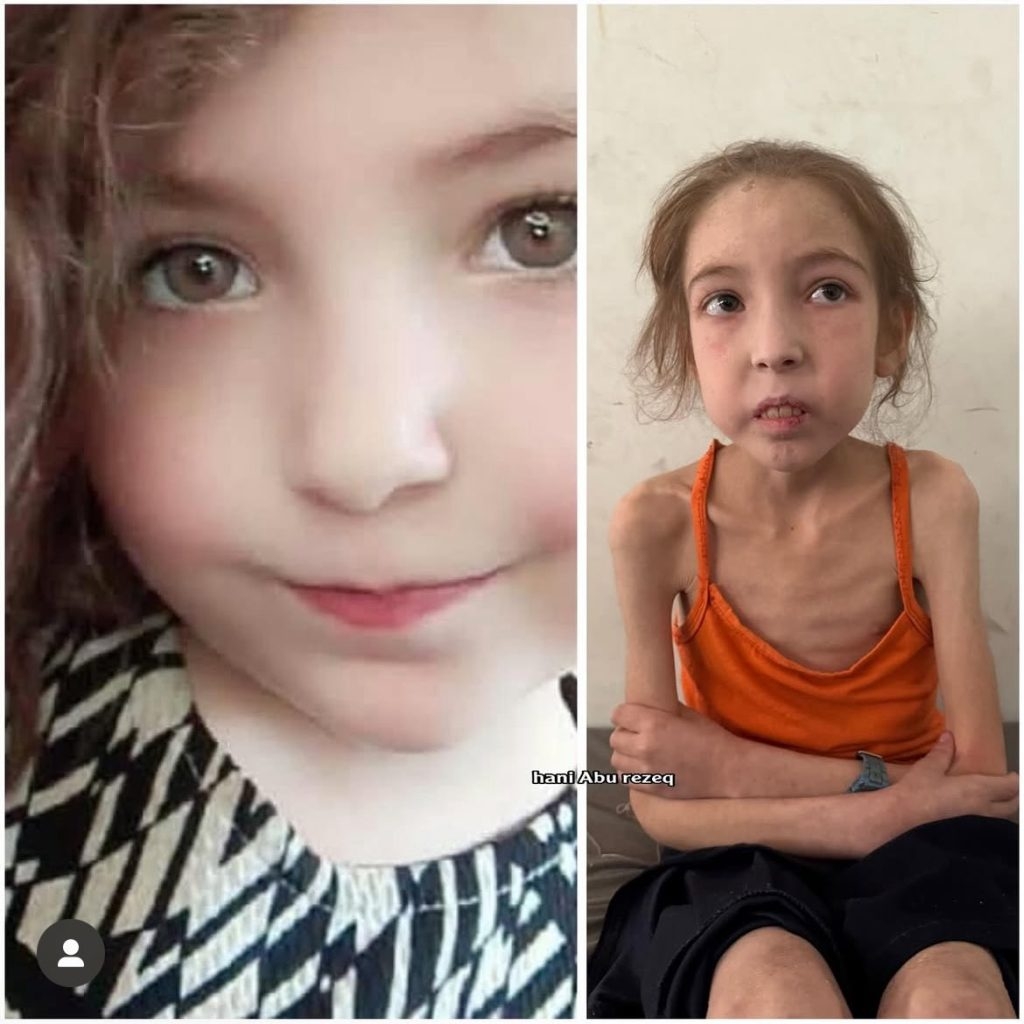 الطفولة في غزة لا تكبر بل تذبل.. مأساة طفلة يقتلها الجوع بصمت