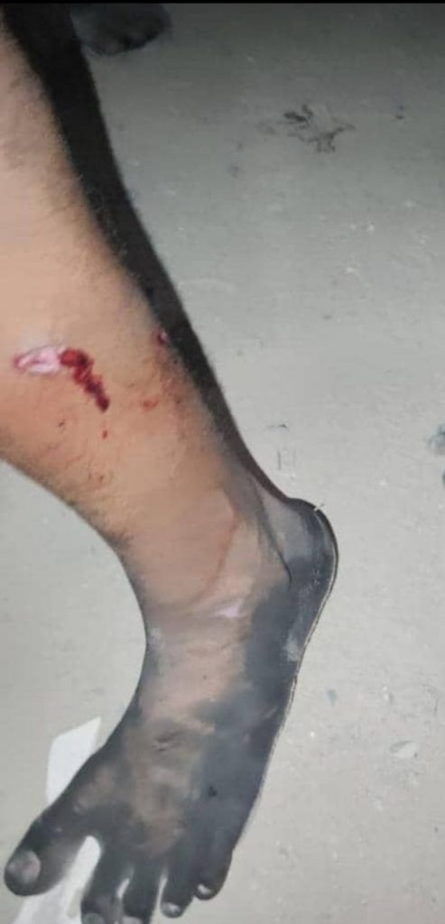 شاهد.. مجندو التحالف يطلقون النار من الاسلحة الخفيفة والمتوسطة على المتظاهرين في مفرق فوة بمدينة المكلا وسقوط إصابات (فيديو)