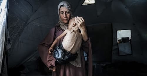 د. الفرا: الوضع في مستشفيات غزة 'كارثي' بسبب نقص أبسط المواد الطبية