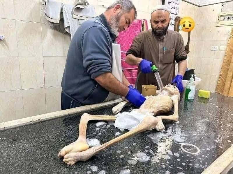 سياسي انصار الله يدعو شعوب الأمة للتحرك لإنقاذ الجوعى والعطشى في غزة