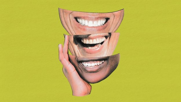 Williams Syndrome: The people who are too friendly