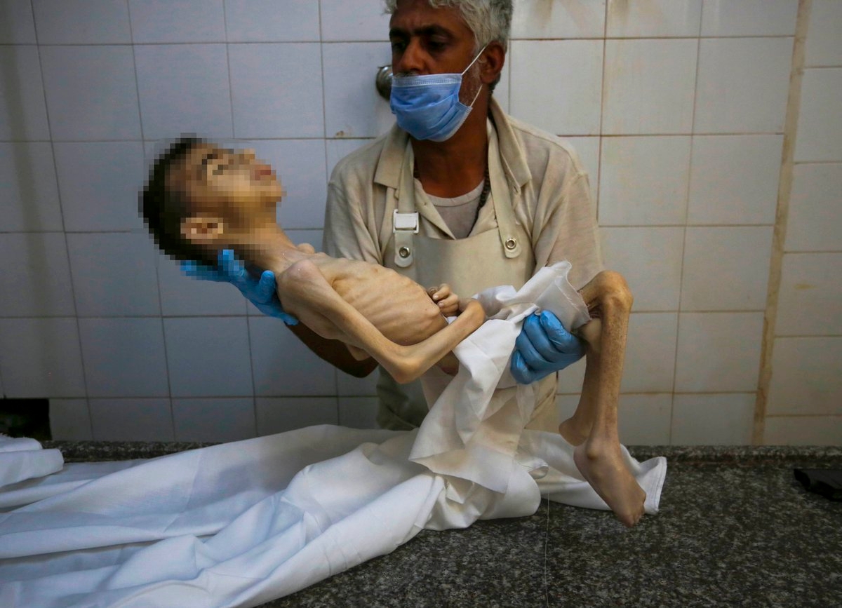 الاورومتوسطي: 26 فلسطينيا ماتوا جوعا في غزة خلال 24 ساعة