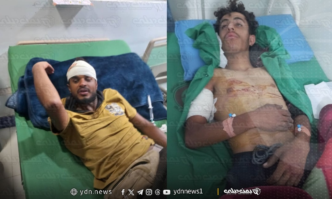 شهود: إصابة أربعة عمال برصاص الحوثيين في الضالع أثناء مطالبتهم بحق العمل