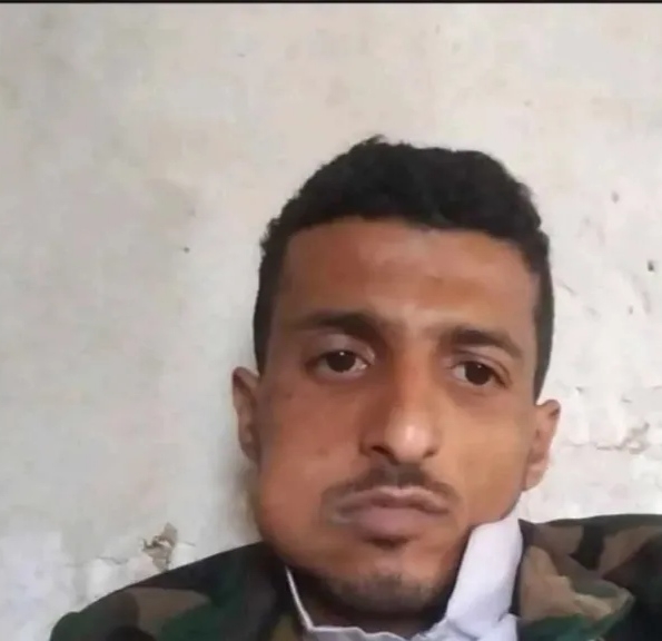 إب.. سكان محليون يعثرون على شاب مشنوقا داخل منزله