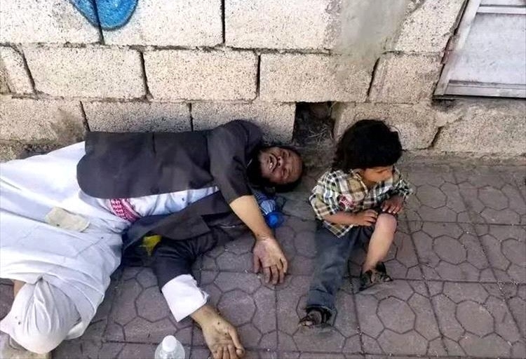 محرر بوفاة مواطن على قارعة الطريق بإب يثير استهجان واسع